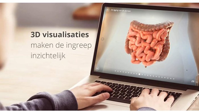 Visualisatie